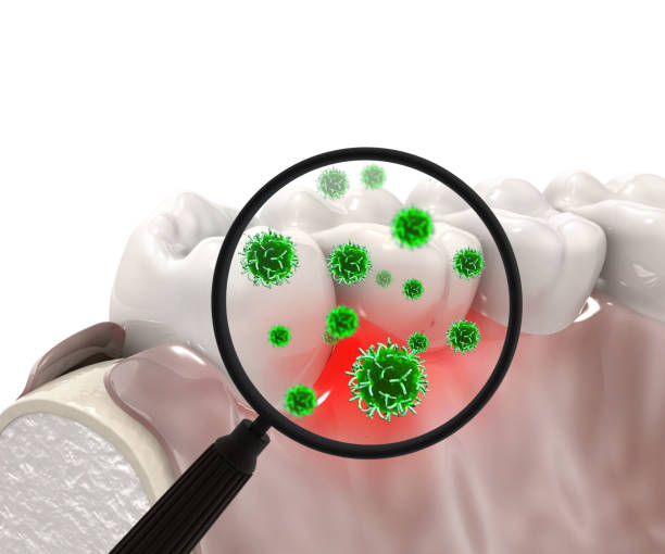 口内環境のイラスト